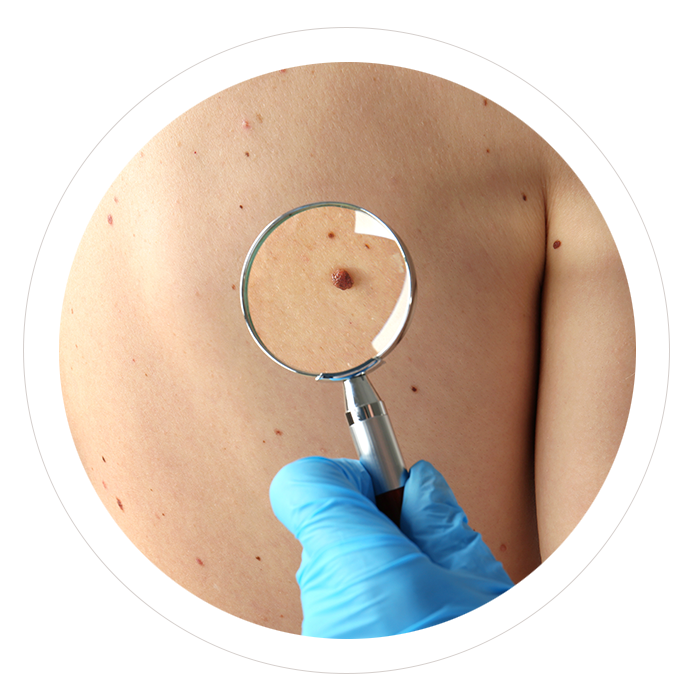 Consulta Dermatología - Dra. Olga Lucía Pardo